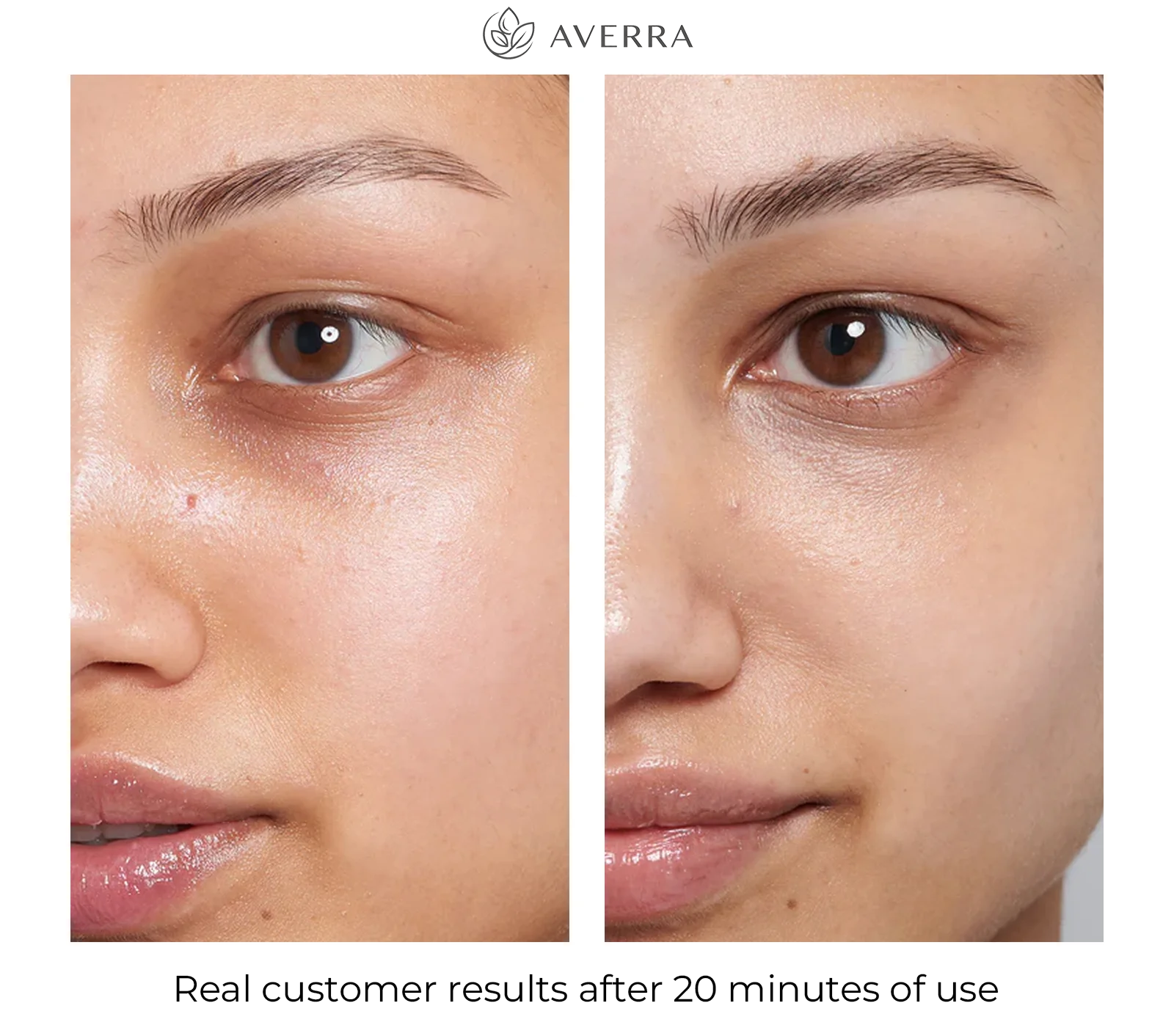 Collagen Eye Patch Results